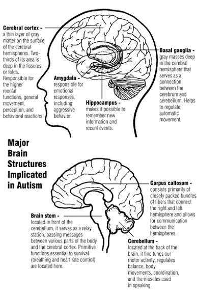 Parts of brain in autism